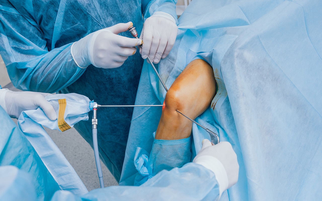 What is knee arthroscopy and what are the precautions you should keep?